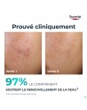 Eucerin Dermopure Clinic.peel.10 Nachtverzorg.40ml