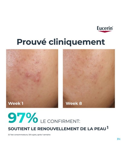 Eucerin Dermopure Clinic.peel.10 Nachtverzorg.40ml